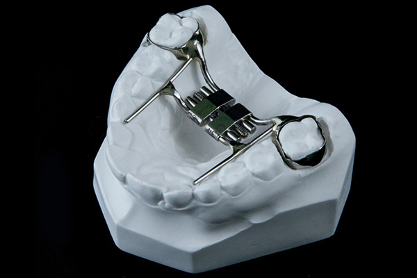 Hyrax Rapid Palatal Expander