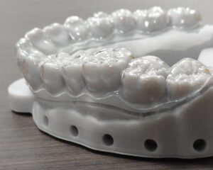 Clear Aligner