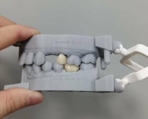 Full Contour Zirconia Crown