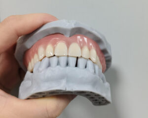 Full Denture
