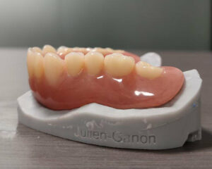 Full Denture