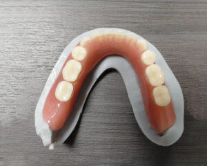 Full Denture