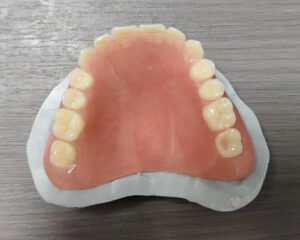 Full Denture