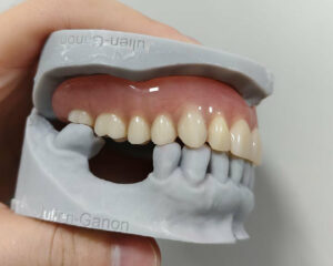 Full Denture