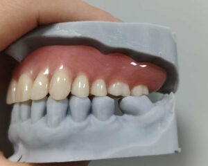 Full Denture