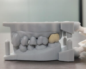PFM Crown