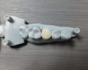 PFM Crown