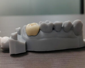 PFM Crown