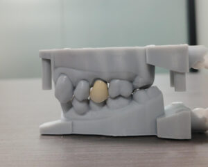 PFM Crown