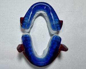 RP-Anti-snoring Appliance