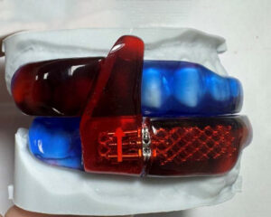 RP-Anti-snoring Appliance