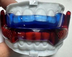 RP-Anti-snoring Appliance