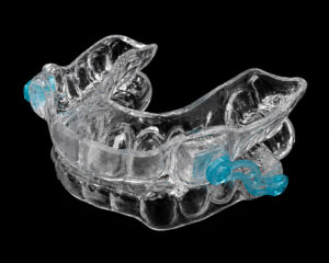 Silensor Anti-snoring Appliance