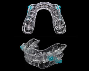 Silensor Anti-snoring Appliance
