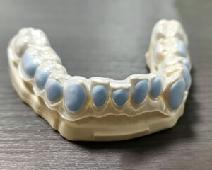 Whitening Trays