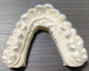 Whitening Trays