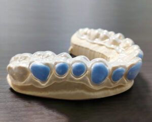 Whitening Trays