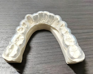 Whitening Trays